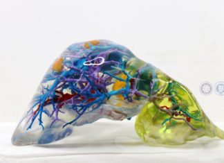 Chinese Team Develops Low-Cost, Highly Accurate Method for 3D Printing Patient-Specific Liver Models