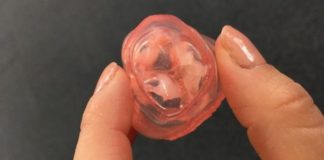 3D Printing in Prevention of Heart Valve Complications