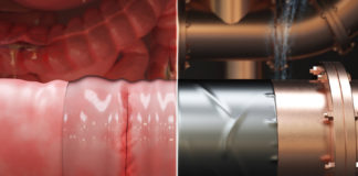 Engineers develop surgical “duct tape” as an alternative to sutures