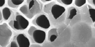 Drexel’s MXene Filter Materials for Wearable Artificial Kidney Technology