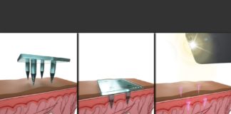Storing Medical Information Below the Skin’s Surface